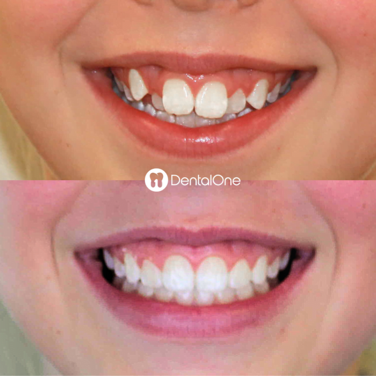 DentalOne Results