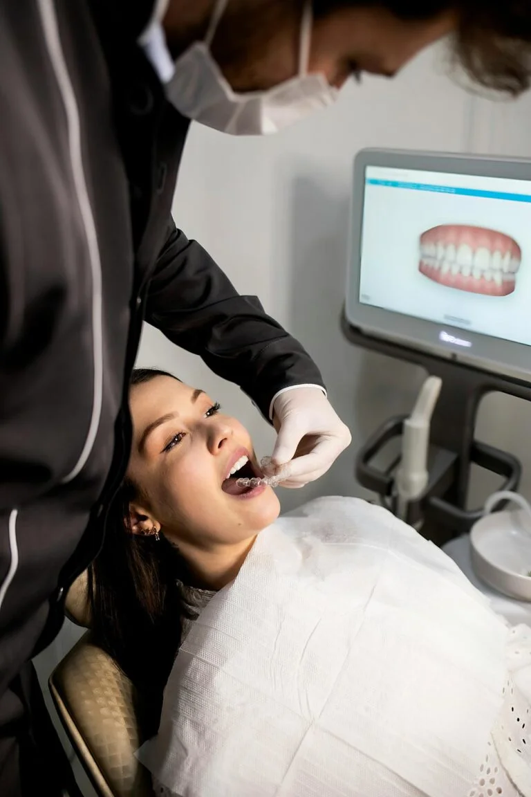 Clear Aligners