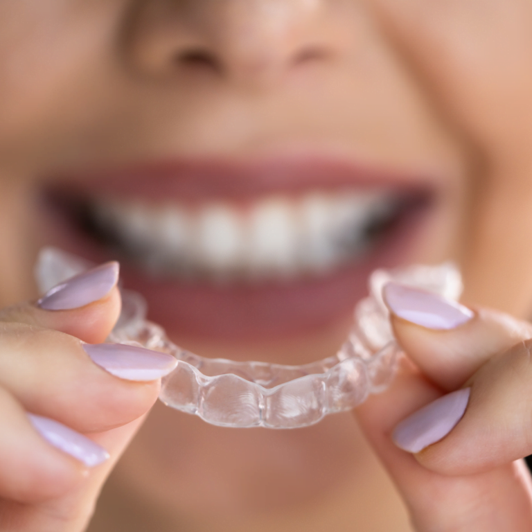 Purple Simple Dental Veneers Instagram Post 29