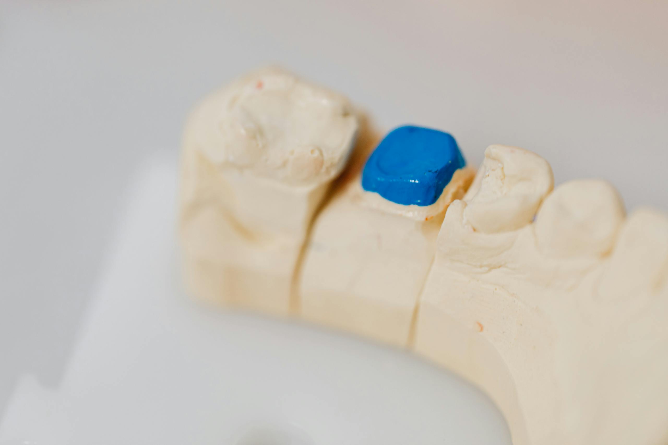 Close-up of a dental jaw model with a blue filling, showcasing dental anatomy and dentistry tools.