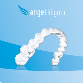 Angel Aligner Web Assets - Social Media - 1080 x 1080px7